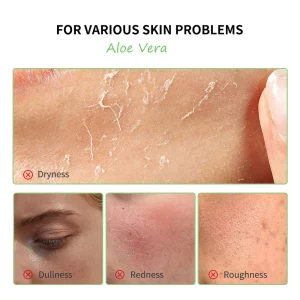 Aloe Vera 5 Pcs Skin Care Set - Thumbnail Image 3