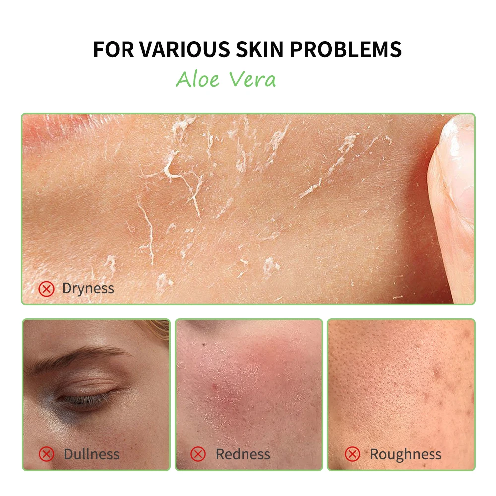 Aloe Vera 5 Pcs Skin Care Set - Image 3